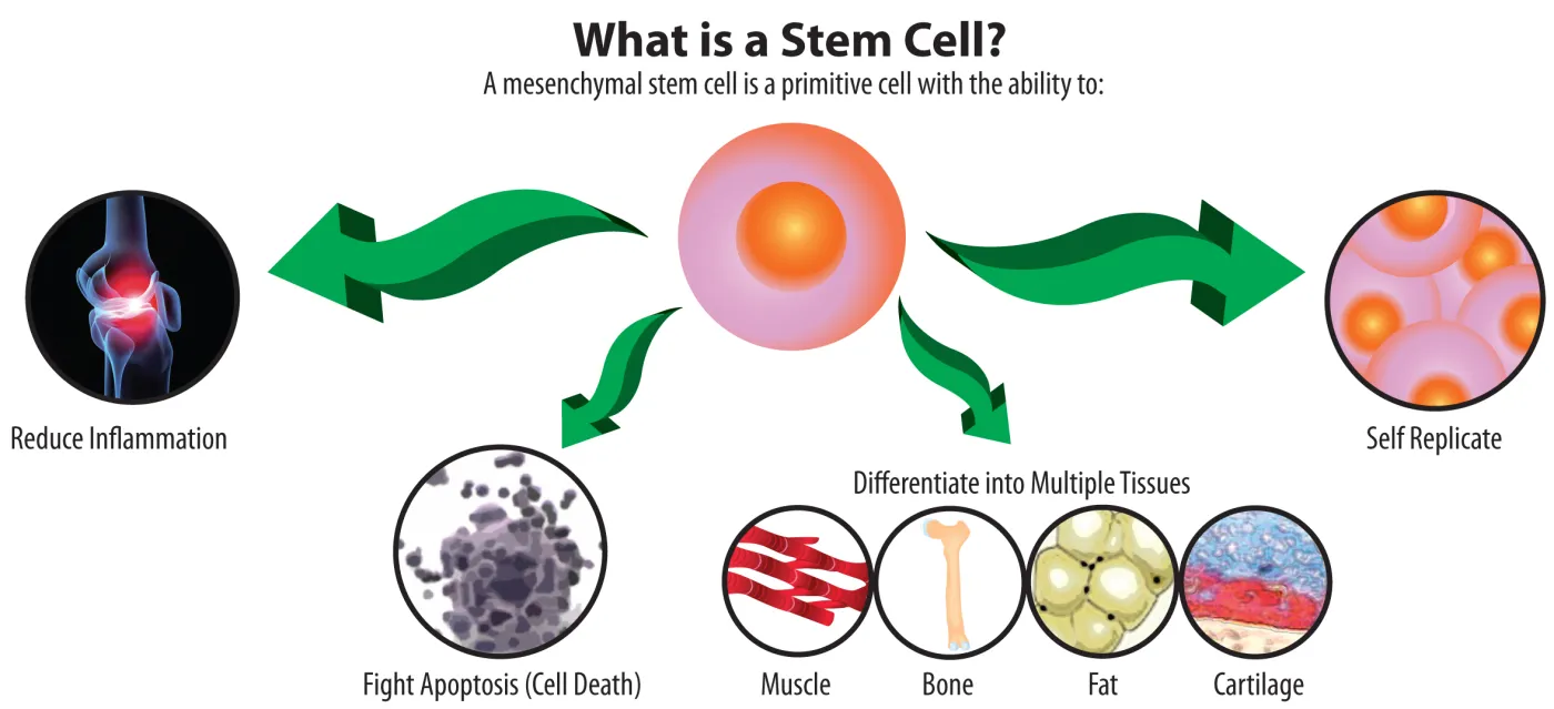 Celula stem mezenchimală: reduce inflamația, se diferențiază în mușchi, os, grăsime și cartilaj